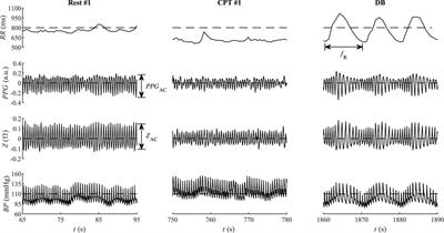 Induced pain affects auricular and body biosignals: From cold stressor to deep breathing